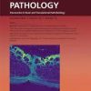 The American Journal of Pathology PDF