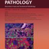 The American Journal of Pathology PDF