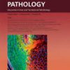 The American Journal of Pathology PDF