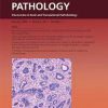 The American Journal of Pathology PDF