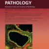 The American Journal of Pathology PDF