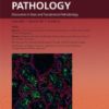 The American Journal of Pathology PDF