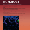 The American Journal of Pathology PDF