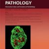 The American Journal of Pathology PDF