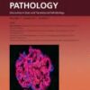 The American Journal of Pathology PDF