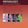 The American Journal of Pathology PDF