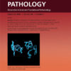 The American Journal of Pathology PDF