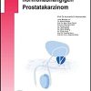 Androgenblockade beim hormonabhängigen Prostatakarzinom (UNI-MED Science) (German Edition) (PDF)