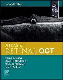 Atlas of Retinal OCT: Optical Coherence Tomography, 2nd Edition (EPUB)