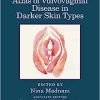 Atlas of Vulvovaginal Disease in Darker Skin Types (EPUB)