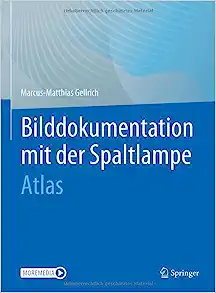 Bilddokumentation mit der Spaltlampe: Atlas (German Edition) (PDF)