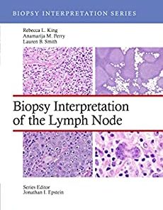 Biopsy Interpretation of the Lymph Nodes (Biopsy Interpretation Series) (EPUB)