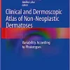 Clinical and Dermoscopic Atlas of Non-Neoplastic Dermatoses: Variability According to Phototypes (PDF) Clinical and Dermoscopic Atlas of Non-Neoplastic Dermatoses: Variability According to Phototypes (PDF)