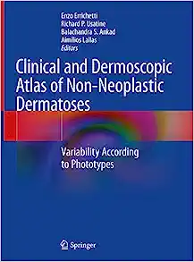 Clinical and Dermoscopic Atlas of Non-Neoplastic Dermatoses: Variability According to Phototypes (PDF)