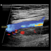 Clinical Approach to Vascular Ultrasound and RPVI Prep Course 2023 (Course)