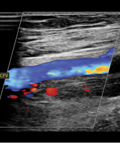 Clinical Approach to Vascular Ultrasound and RPVI Prep Course 2023 (Course)