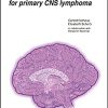 Current treatment concepts for primary CNS lymphoma (UNI-MED Science) (PDF)