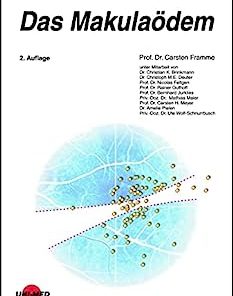 Das Makulaödem (UNI-MED Science) (German Edition), 2nd Edition (PDF)