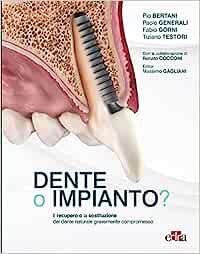 Dente o impianto? Il recupero e la sostituzione del dente naturale gravemente compromesso (EPUB)