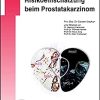 Diagnostik und Risikoeinschätzung beim Prostatakarzinom (UNI-MED Science) (German Edition) (PDF)