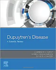 Dupuytren’s Disease: A Scientific Review (EPUB)