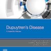 Dupuytren’s Disease: A Scientific Review (PDF)