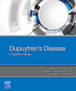 Dupuytren’s Disease: A Scientific Review (PDF)