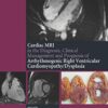 The Cardiac MRI in Diagnosis, Clinical Management, and Prognosis of Arrhythmogenic Right Ventricular Cardiomyopathy/Dysplasia