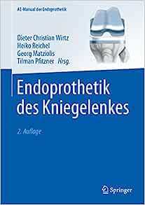 Endoprothetik des Kniegelenkes (AE-Manual der Endoprothetik) (German Edition), 2nd Edition (EPUB)