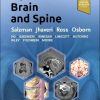 ExpertDDx: Brain and Spine, 3rd Edition (PDF) ExpertDDx: Brain and Spine, 3rd Edition (PDF)