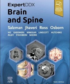 ExpertDDx: Brain and Spine, 3rd Edition (PDF)