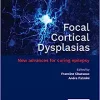 Focal Cortical Dysplasias: New advances for curing epilepsy (EPUB)