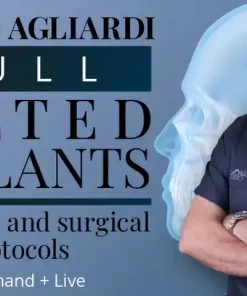 Full tilted implants Prosthetic and Surgical protocols 2023 (Osteocom) (Course)