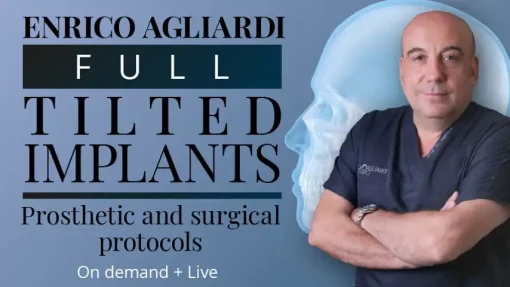 Full tilted implants Prosthetic and Surgical protocols 2023 (Osteocom) (Course)