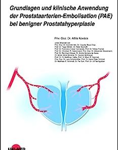 Grundlagen und klinische Anwendung der Prostataarterien-Embolisation (PAE) bei benigner Prostatahyperplasie (UNI-MED Science) (German Edition) (PDF)