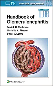 Handbook of Glomerulonephritis (EPUB) Handbook of Glomerulonephritis (EPUB)