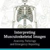 Interpreting Musculoskeletal Images: Anatomy, Pathology and Emergency Reporting (PDF)