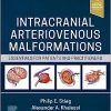 Intracranial Arteriovenous Malformations: Essentials for Patients and Practitioners (EPUB)