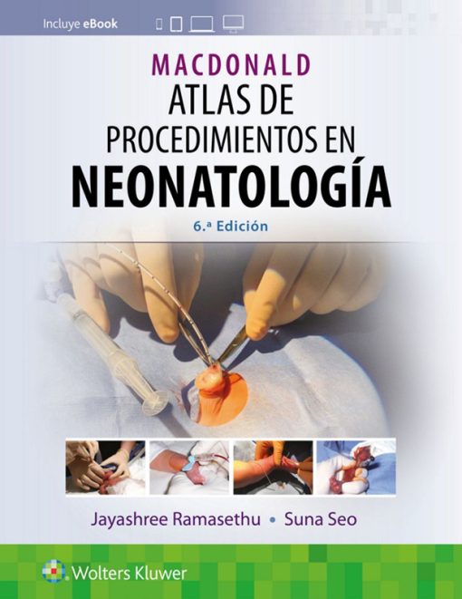 MacDonald. Atlas de procedimientos en neonatología, 6th edition (PDF)