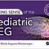 Making Sense of the Pediatric EEG (PDF)