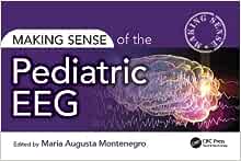 Making Sense of the Pediatric EEG (PDF)