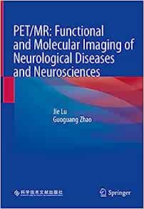 PET/MR: Functional and Molecular Imaging of Neurological Diseases and Neurosciences (EPUB)