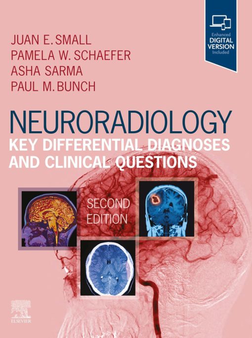 Neuroradiology: Key Differential Diagnoses and Clinical Questions, 2nd edition (EPUB)