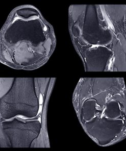 NYU Langone Advanced Imaging of the Musculoskeletal System: Up Your Game 2023 (Course)