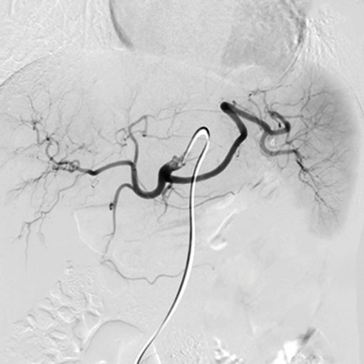 NYU Langone Vascular and Interventional Radiology Review and Update 2023 (Course)