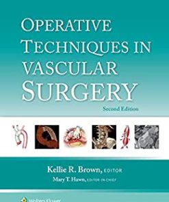 Operative Techniques in Vascular Surgery, 2nd Edition (EPUB)