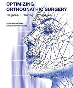 Optimizing Orthognathic Surgery: Diagnosis, Planning, Procedures (EPUB)