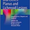 Oral Lichen Planus and Lichenoid Lesions: Etiopathogenesis, Diagnosis and Treatment (EPUB)