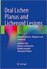 Oral Lichen Planus and Lichenoid Lesions: Etiopathogenesis, Diagnosis and Treatment (EPUB)