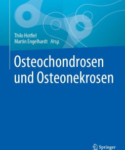 Osteochondrosen und Osteonekrosen (EPUB)
